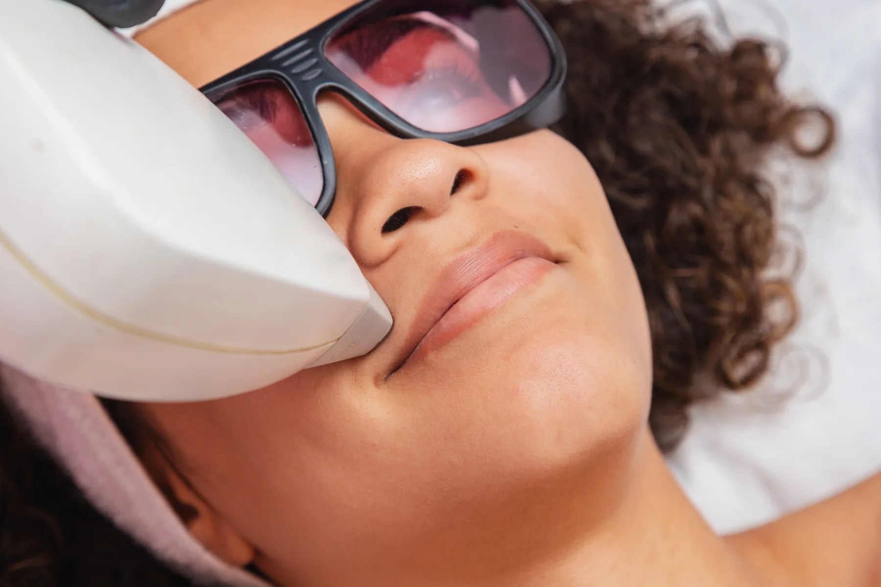 Depilación láser en Marien Skincare Mérida