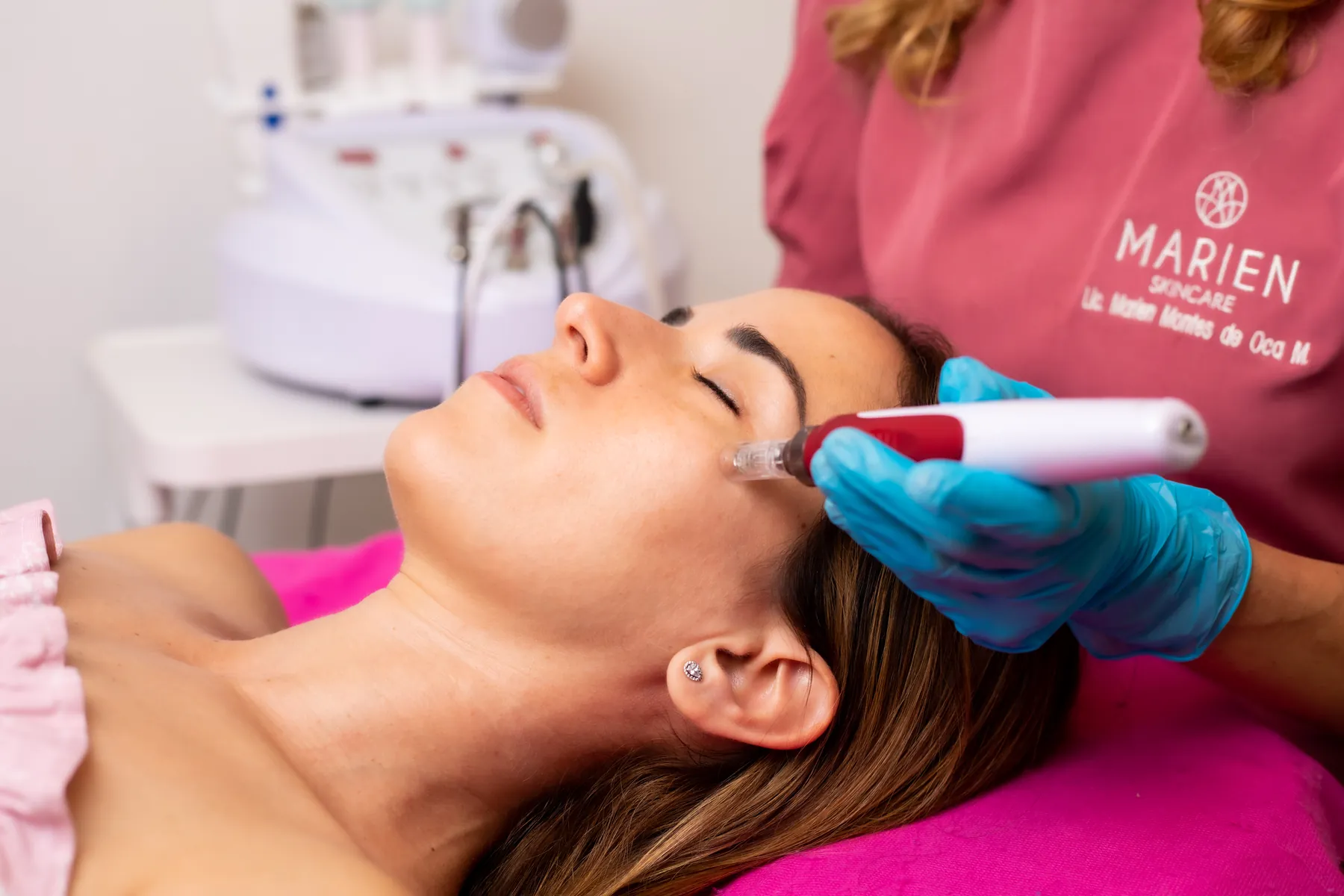 Tratamiento Dermapen con microneedling en Marien Skincare Mérida